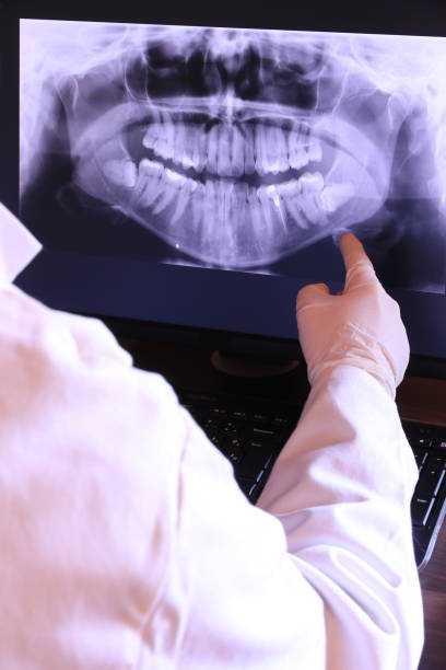 Best Knocked-Out Tooth (Avulsed Tooth) Treatment in North Decatur, GA