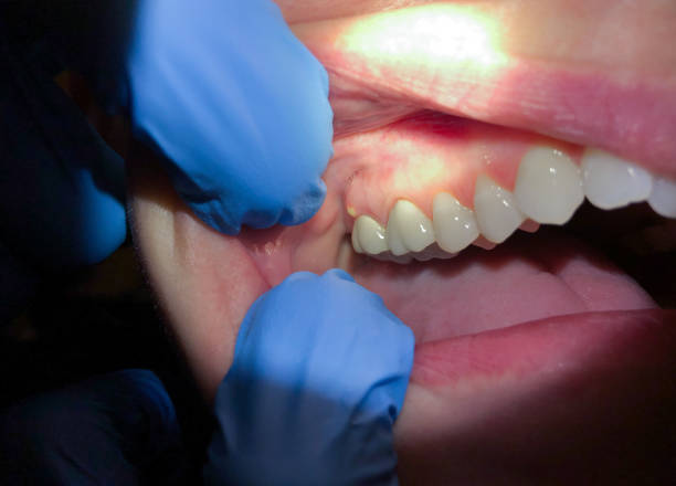 Best Walk-In Emergency Dental Services in North Decatur, GA